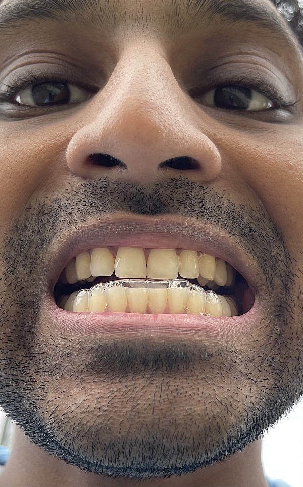 Sporting Smiles Reviews 63 Reviews of Sitejabber