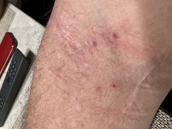 American Red Cross product 0