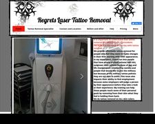 Thumbnail of Regrets Laser Tattoo Removal